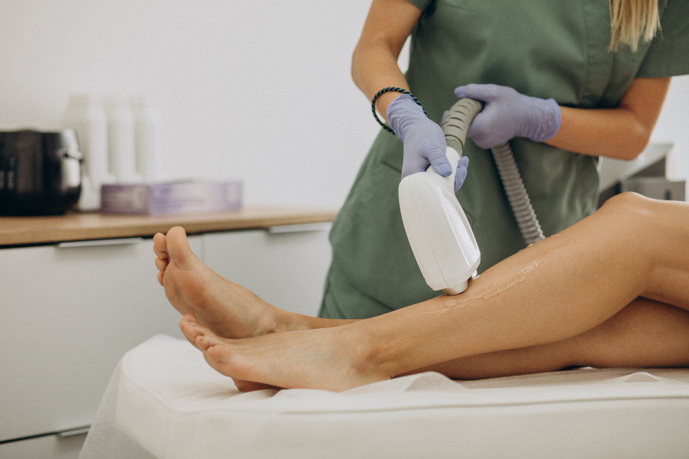 Triple Diode laser for hair removal