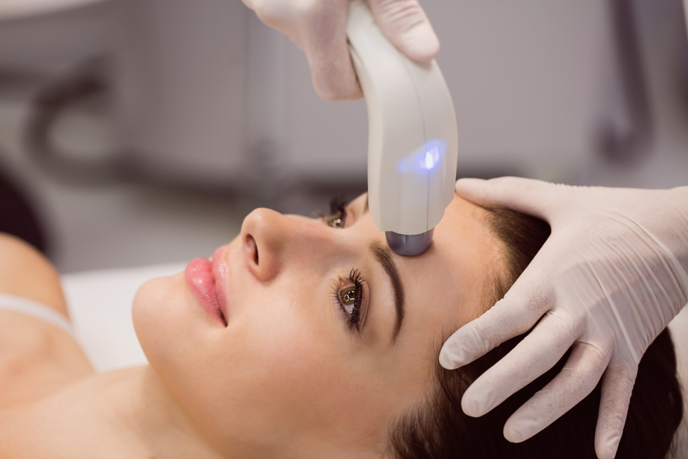 Nd YAG Laser Treatment
