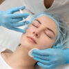 PRP Facials